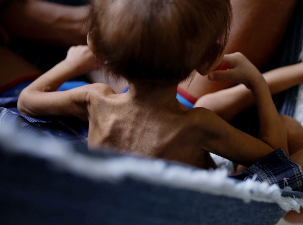 A four-year-old Yanomami Indigenous child, who is treated for malnutrition, sits with his father in a hammock at the special yard for indigenous people of the Santo Antonio Children's Hospital in Boa Vista, Brazil, Jan. 27, 2023. (OSV News/Reuters/Amanda Perobelli)