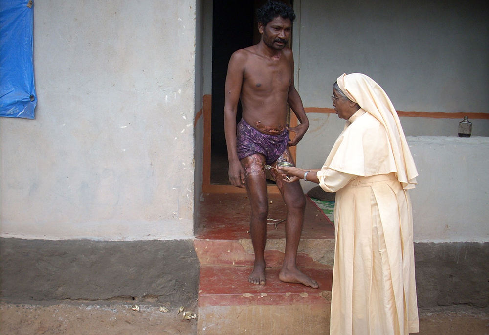 Sr. Innocent Joseph Ayyankanal, a member of the Missionary Sisters of Mary Immaculate, visits a patient at home and applies herbal medicine to treat burns in a tribal home in the Wayanad district of Kerala, southwestern India. (Courtesy of Sr. Innocent Joseph Ayyankanal)
