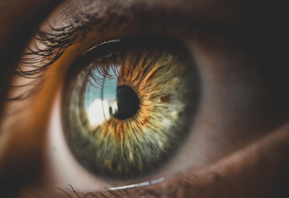 A close-up photo illustration a close-up of an human eye has a reflection in its center of a white building against a blue sky. (Pixabay/Bruno Henrique)