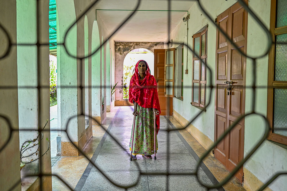 Furkun Begum, 51, has lived with leprosy for 30 years. After being driven from her village, she now seeks peace and a better life through the center's care. (Piyas Biswas)